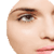 Healthy Brow