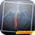 Back Pain_Relief