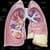 Mesothelioma asbestos cancer labs