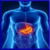 Cure for Stomach Ulcers