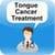 Tongue Cancer Treatment
