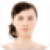 Acne Rosacea Cure