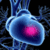 Cure for Coronary Heart Disease