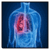 Bronchitis