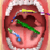 Winter Tonsils Surgery Simulator 2018